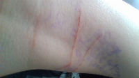 guys...
i need help...
those red marks are cuts...
im cutting again...
help me please...